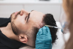 How Does PRP Treatment Improve Blood Flow to Hair?