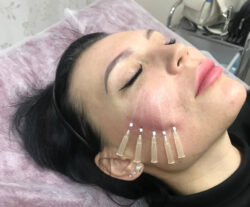 How Effective Are PDO Mono Threads for Skin Rejuvenation?