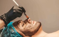How suitable is laser carbon peel for all skin tones?