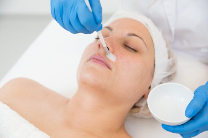 Is Glycolic Acid Peel Good for Improving Skin Texture?