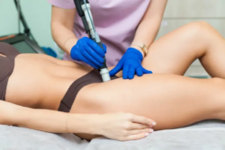 Laser Vaginal Tightening for Better Intimate Wellness