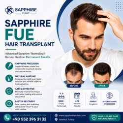 Sapphire FUE Hair Transplant at Sapphire Hair Clinic: What You Need to Know