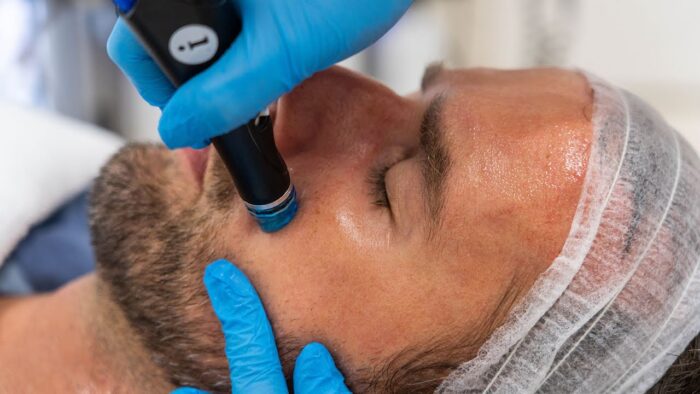 What Results Can Men Expect From Hydrafacial Treatment?