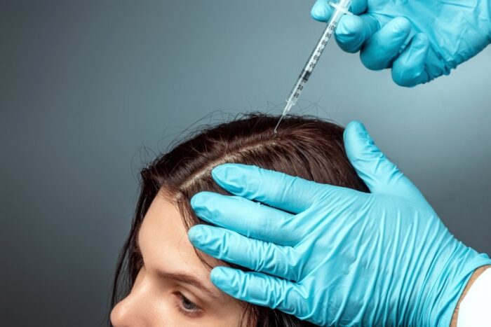 What Results Can You Expect From GFC Hair Treatment?