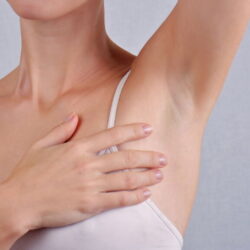 What Results Can You Expect From Underarm Carbon Peel?