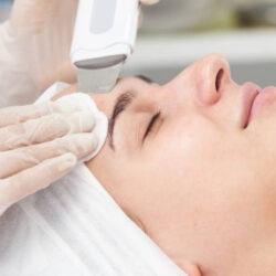 Why Does Skin Resurfacing Support New Skin Formation?