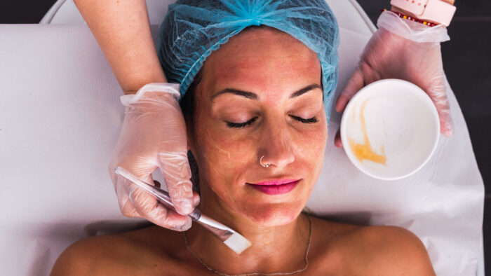 Can Cosmelan Peel Be Used for Sensitive Skin Type?
