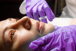 Can Lip Filler Injections Change Your Overall Face Perception?