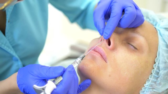 Can Nose Fillers Fix A Bumpy Nose Bridge Naturally Today?