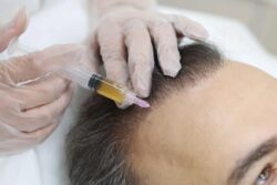 Can PRP Hair Therapy Improve Hair Texture Too?