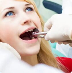 Tooth Extraction Penrith