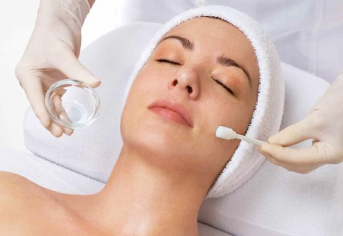 Does Chemical Peel Remove Dead Skin Cells Safely?