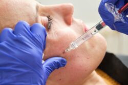 Does Vampire Facial Improve Skin Elasticity Over Time?