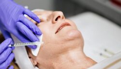 How Can Jawline Fillers Improve Your Side Profile Shape?