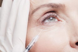 How Long Do Under Eye Fillers Last Under the Eyes?