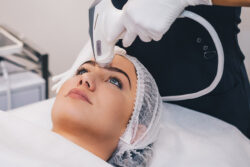 How Soon Do You See Changes After Pico Laser Treatment?