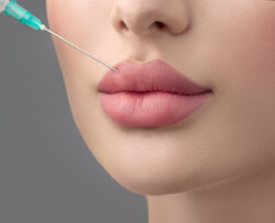 Does Lip Fillers injection help achieve iconic pout perfection?