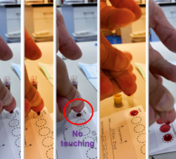 TSH Blood Test