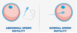Sperm Testing Near Austin Texas