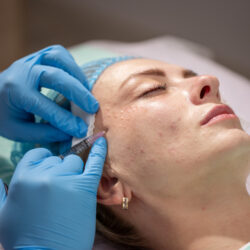 What Happens Inside Skin After Skin Booster Injections?