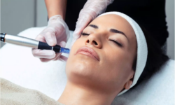 What Results Can You Expect From Dermapen Microneedling?