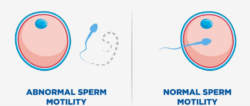 Semen Analysis Cost Austin TX