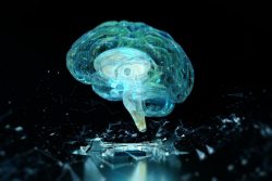 Health spa Remedies Are Not Only An Extravagance