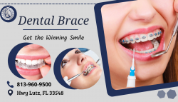 Straighten Teeth by Dental Braces