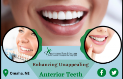 Rebuild your Smile with Dental Veneers