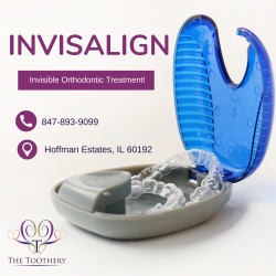 Invisible Aligners For Beautiful Teeth