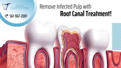 Root Canal Therapy to Protect Infected TeethRoot Canal Therapy to Protect Infected Teeth