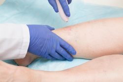 Nationally Recognized Vein Doctor in Illinois | Do I Need a Vein Dr in IL?