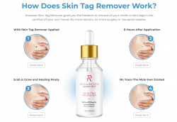Amarose Skin Tag Remover – Moisturizer With Ultimate Skin Benefits