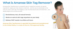 Amarose Skin Tag Remover™ {Most Trusted Skin Care} Ultimate Formula