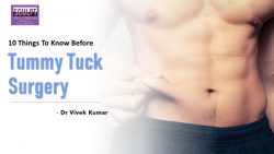 10 Things to Know Before Tummy Tuck Surgery in Delhi