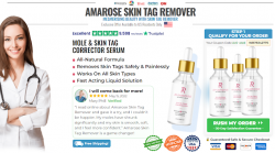 Amarose Skin Tag Remover Reviews – Mole Removal Formula, Price for Sale & Benefits!