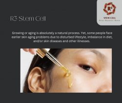 R3 stem cell | How do you get Stem Cell Treatment for Anti Aging?