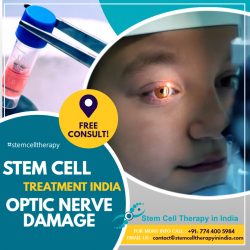 Why India For Stem Cell Treatment For Optic Nerve Damage