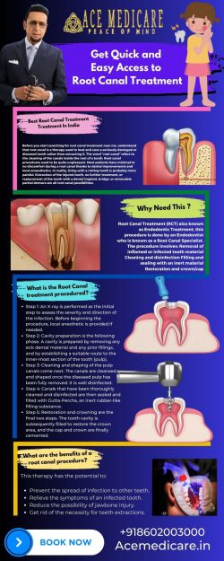 Get Quick and Easy Access to Root Canal Treatment – Ace Medicare