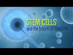 DOES STEM CELL THERAPY HELP IN THE TREATMENT OF NEUROPATHY?