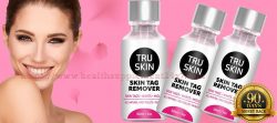 TruSkin Skin Tag Remover {Fast Acting Serum} Get Rid From All Types Skin Tags, Moles And Warts(S ...