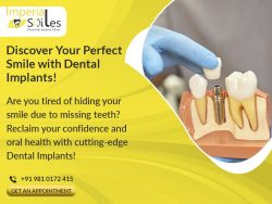 Dental Implants in Gurgaon | Imperial Smiles Dental And Implant Clinic