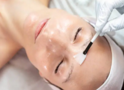 Scar Wars: How Acne Scar Facials Win the Battle for Smooth Skin- Vivid Skin & Laser Center