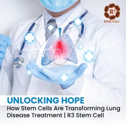 Unlocking Hope: How Stem Cells Are Transforming Lung Disease Treatment | R3 Stem Cell