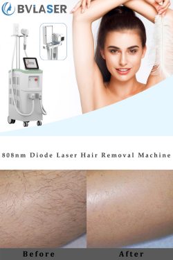 The best professional laser hair removal machine brand-BVLASER. 808nm diode laser hair removal m ...