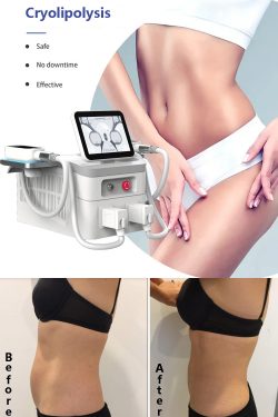 Cryolipolysis body contouring. Cryolipolysis fat freeze slimming machine. Cryolipolysis beauty e ...