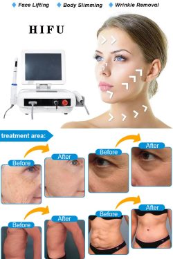 OEM portable HIFU ultrasound. HIFU machine for body and face professional. China new technology  ...
