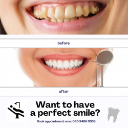 Smile Perfect: Your Comprehensive Guide to Dental Beauty