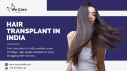 Hair Transplant in India