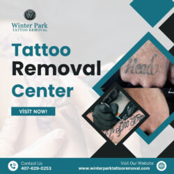 Effective Tattoo Removal Center – Winter Park Tattoo Removal